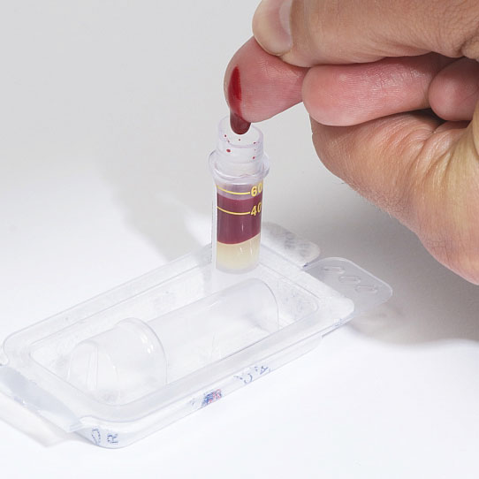 Blood sample for STI test